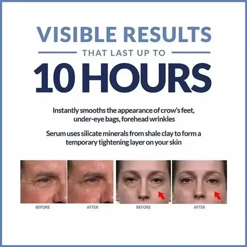 Yoniq™ | Instant Eye Cream