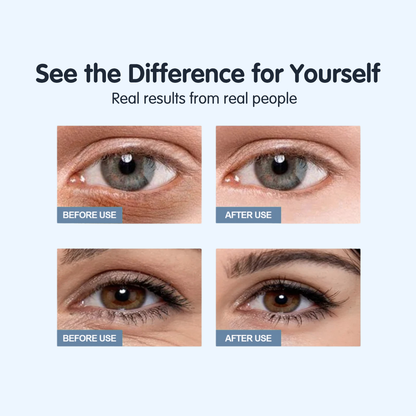 Yoniq™ | Instant Eye Cream